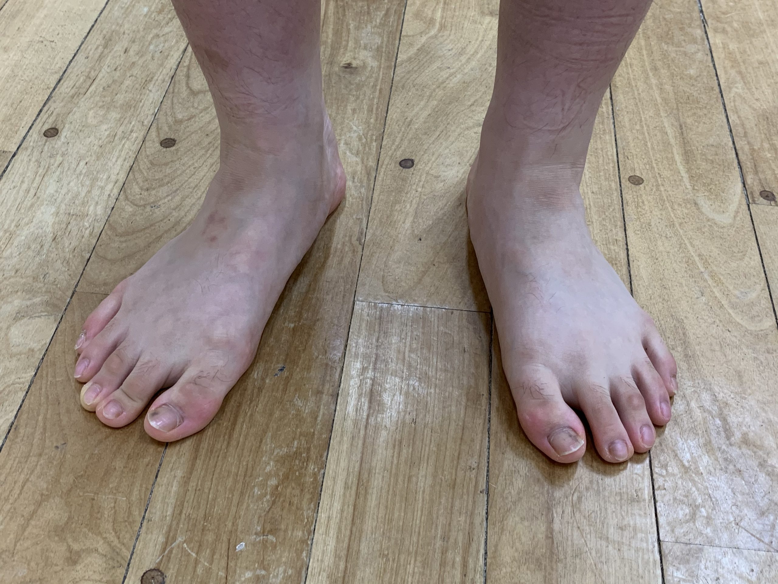 5. 階段アーチの上昇